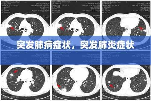 突发肺病症状，突发肺炎症状 